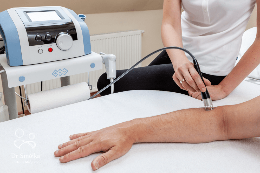 terapia ręki laserem wysokoenergetycznym